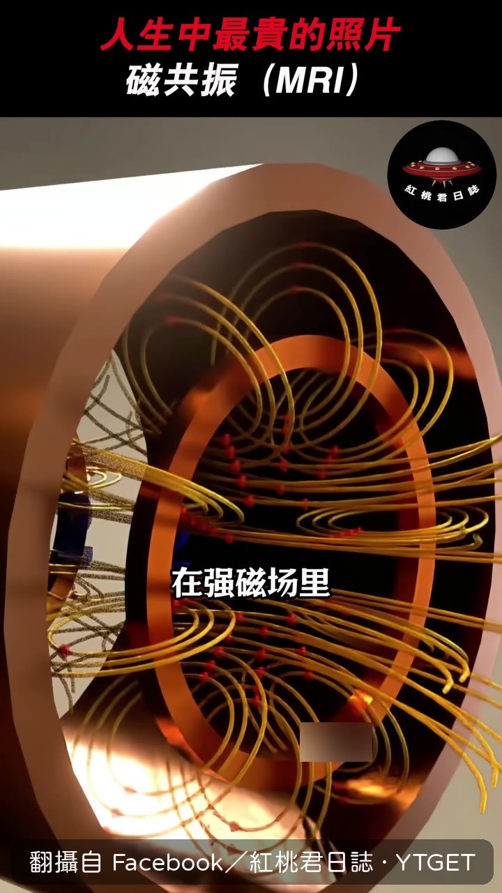 梯度線圈快速開關產生機械震動