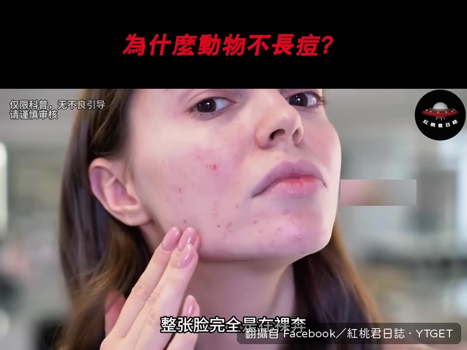 人類臉上有兩萬多個毛孔