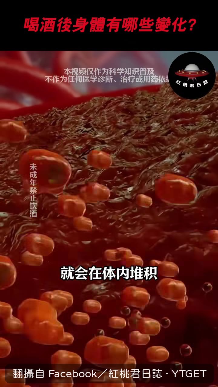 乙醛堆積導致酒後上臉頭痛