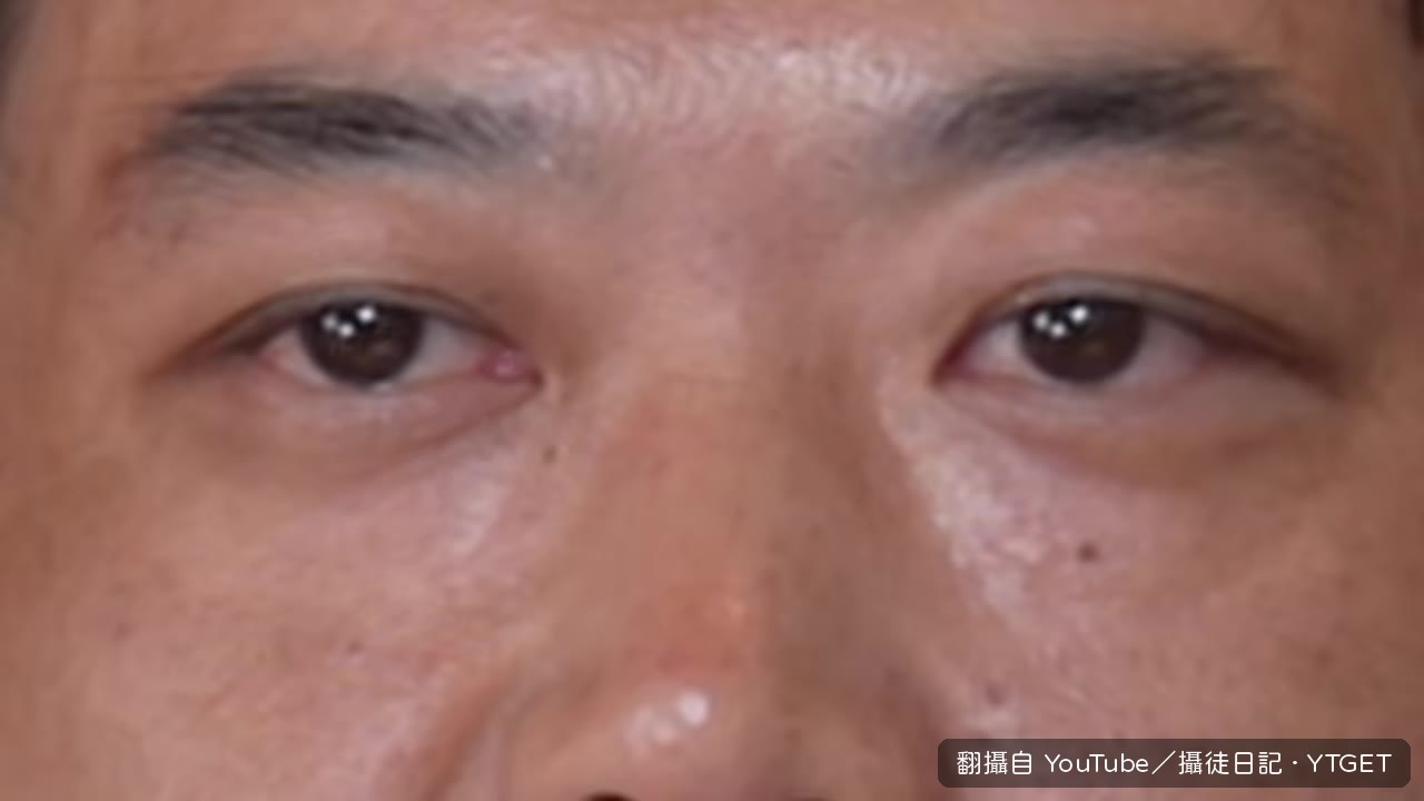 疫情期間人死了通報卻寫還在治療