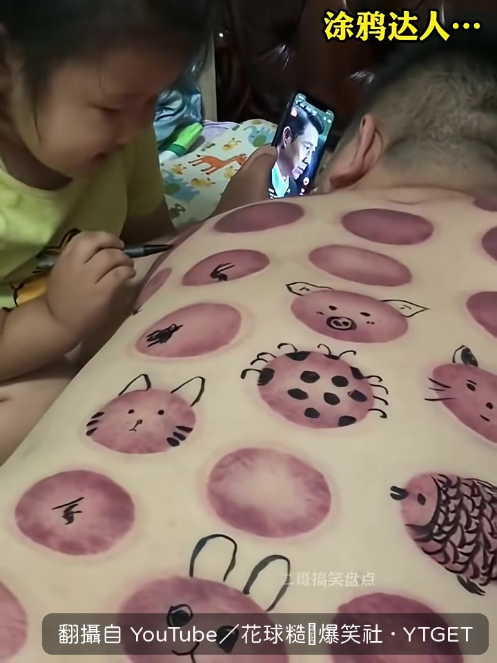 爸爸認真問ICU一天多少錢