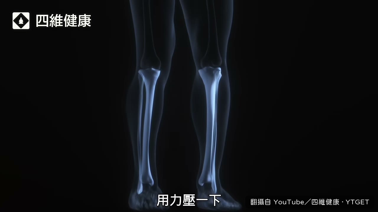 大拇指壓脛骨數五秒，放開看有沒有坑